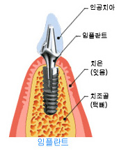 내부이미지