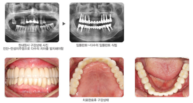 내부이미지