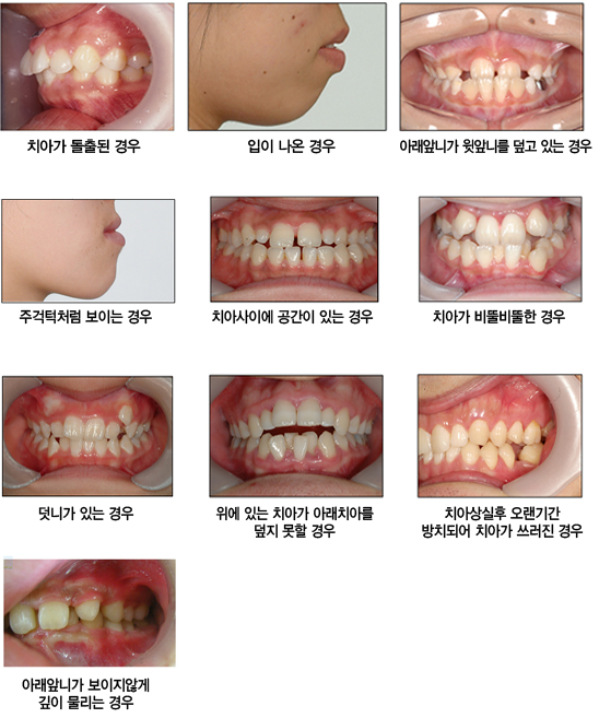 내부이미지