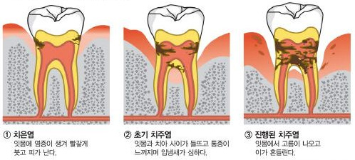 내부이미지