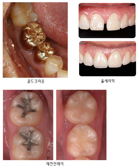 내부이미지