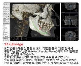 내부이미지