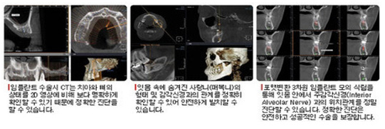 내부이미지